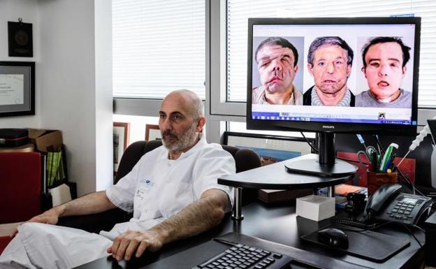El cirujano responsable de la operación. / AFP/