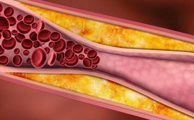 Reducir el colesterol después de los excesos del verano