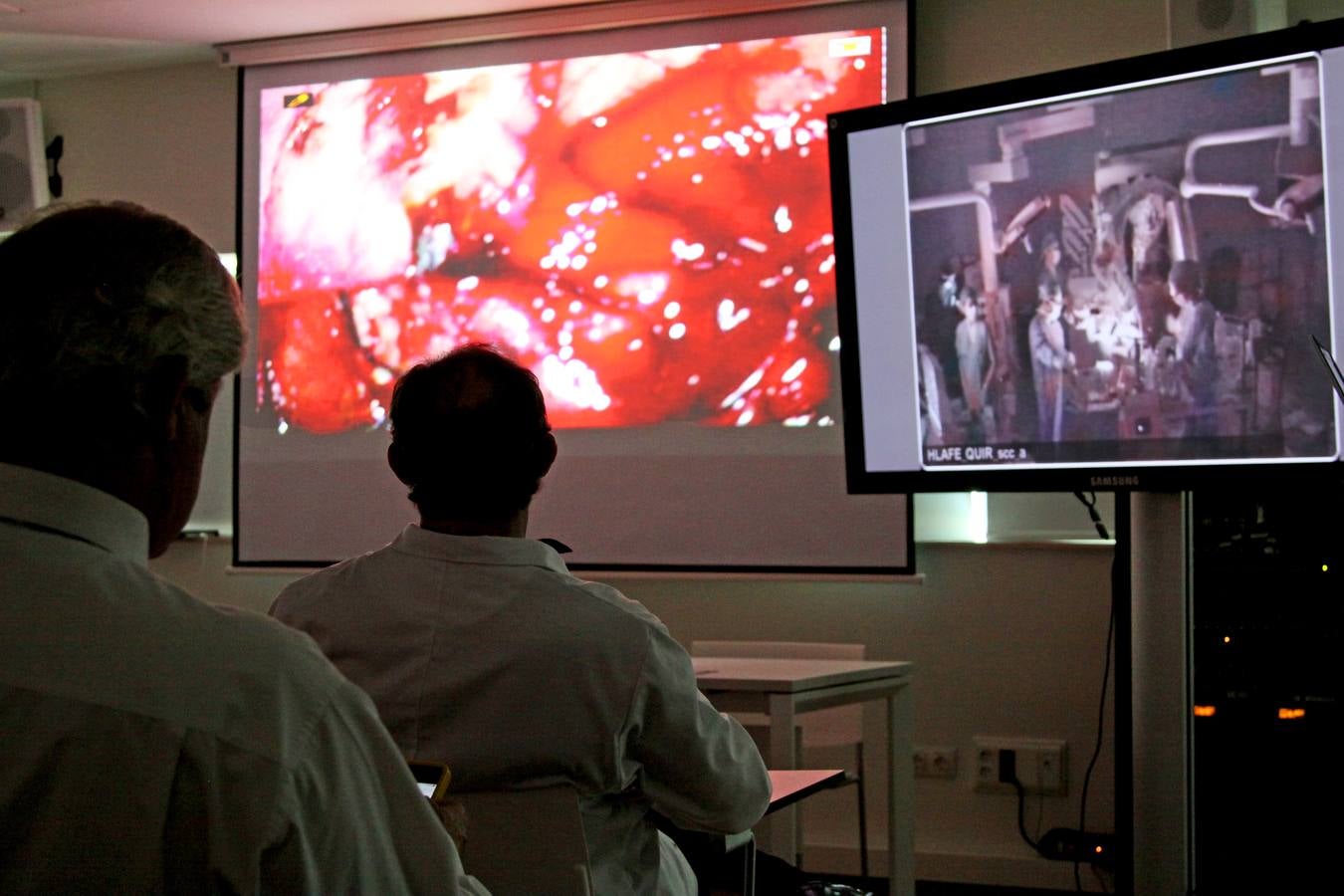 La Fe aplica la fluorescencia para extirpar tumores cerebrales