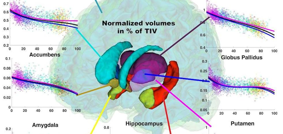 El cerebro del hombre envejece peor que el de la mujer