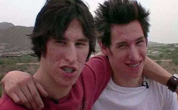 Los gemelos que se operaron para ser como Brad Pitt