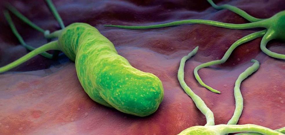 Helicobacter pylori, la peligrosa bacteria estomacal que tiene el 54% de la población