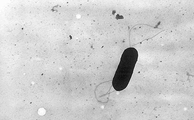 La bacteria que ha matado a tres personas en Australia