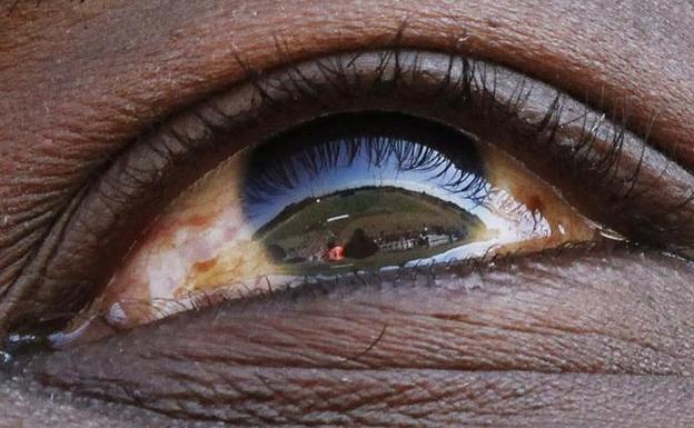 La visión láser, más cerca de llegar al ojo humano