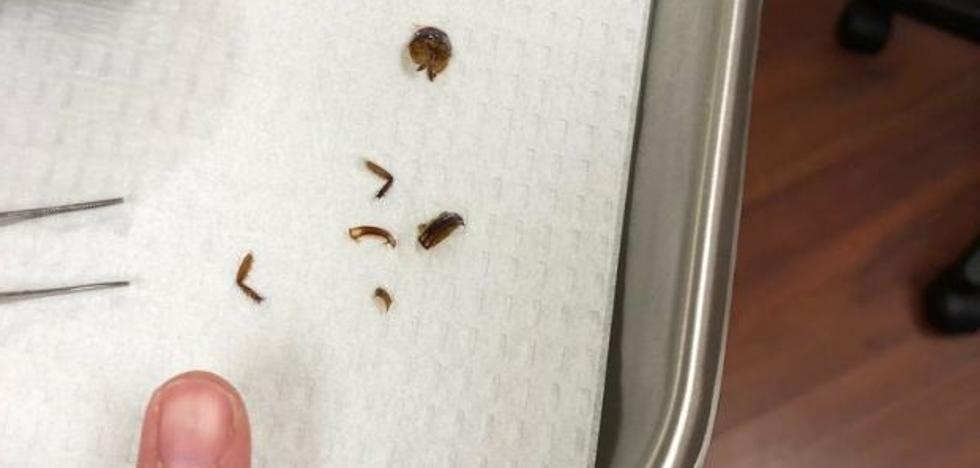 Extraen una cucaracha viva del oído de una joven