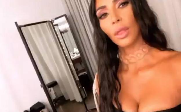 El último implante de Kim Kardashian impacta en las redes sociales