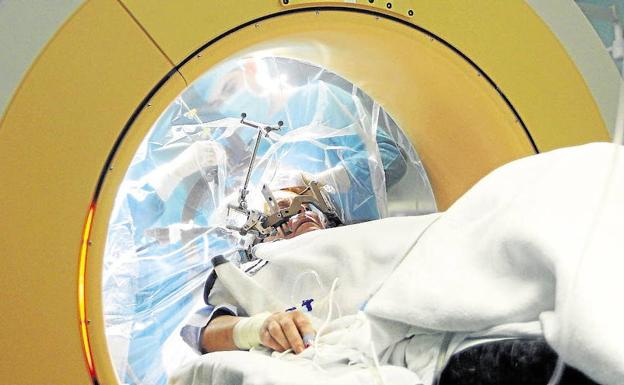 CirugÃa robótica contra el parkinson en Valencia.