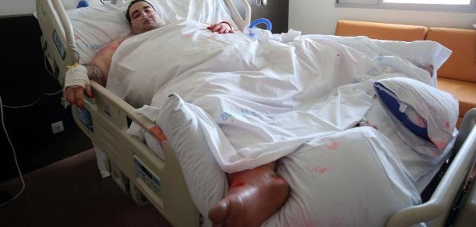 Teo, el joven de Turís con obesidad mórbida, abandona el hospital