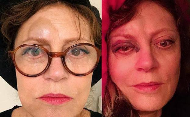 La actriz Susan Sarandon, desfigurada tras sufrir un pequeño accidente