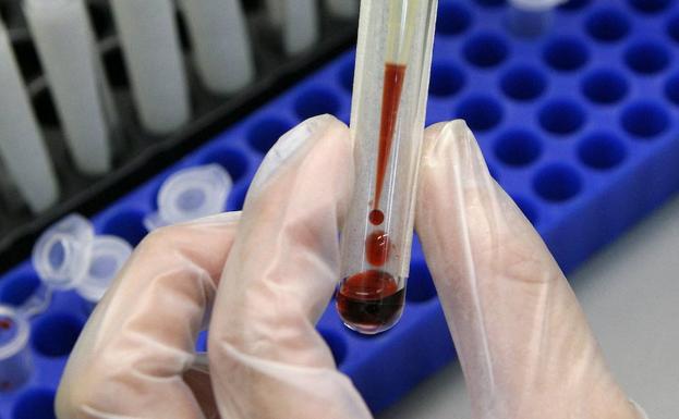 Crean una tecnología para detectar cáncer con una sola gota de sangre