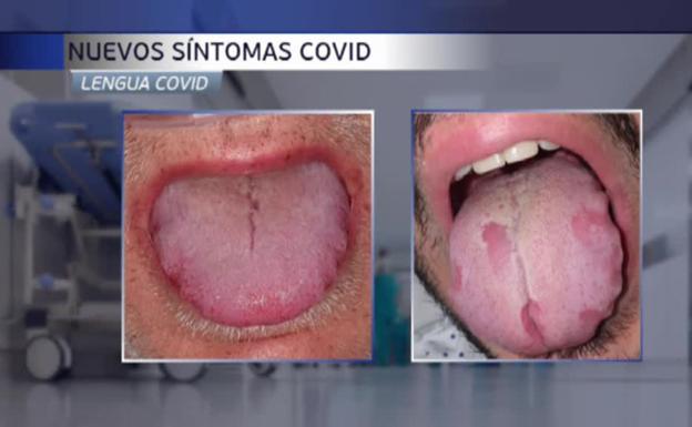 Fallos y aciertos del doctor Cavadas sobre el coronavirus