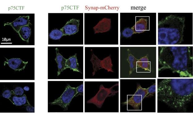 Descubren en Valencia por qué algunos medicamentos usados contra el Alzheimer causan efectos secundarios