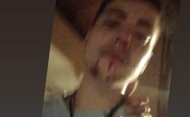 Un joven trans denuncia una agresión en Valencia: «Me reventaron la nariz»