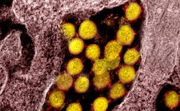 Desvelan por qué la variante Alfa es mucho más mortal que Ómicron