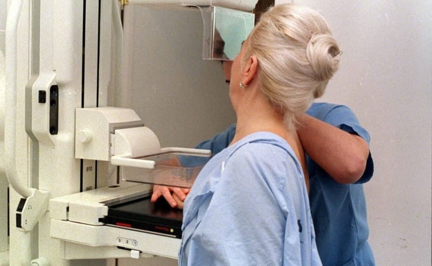 Sanidad extiende el cribado de cáncer de mama a la detección precoz del cáncer de cuello de útero