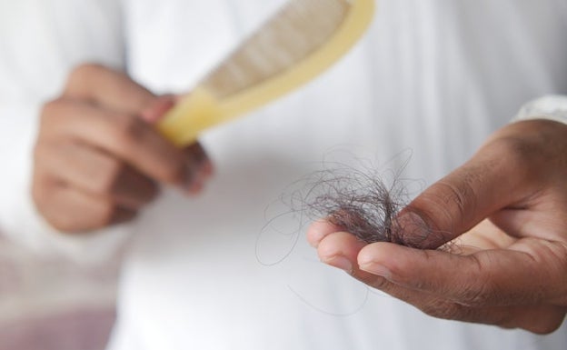 Alopecia: cuántos pelos al día es normal que se caigan