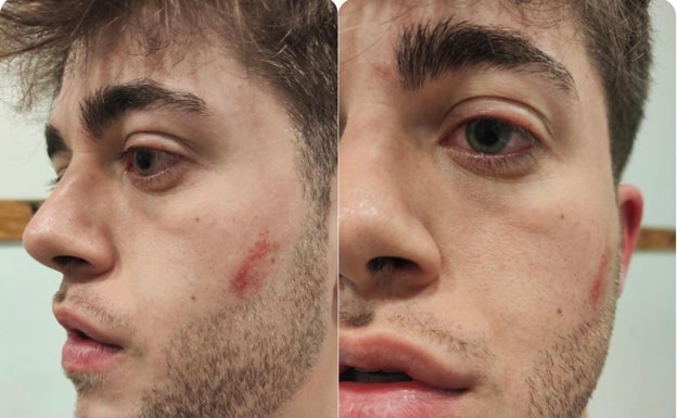 Dura sanción a un jugador del Evangélico FC de Segunda Regional por una agresión al colegiado