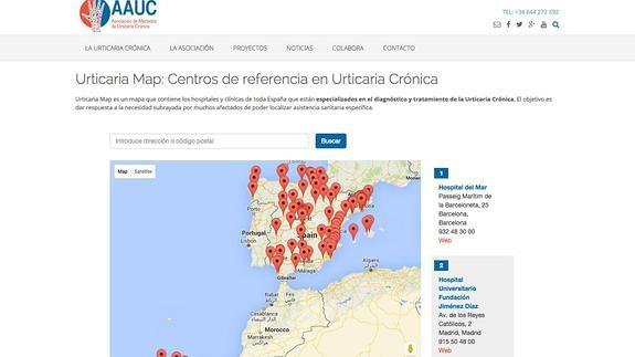 Creado el mapa de los centros de referencia en urticaria crónica