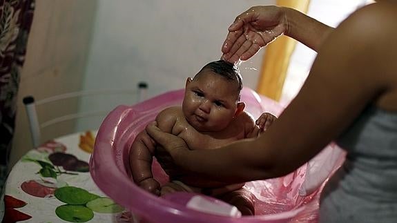 Hallan una nueva evidencia del vínculo entre el zika y las malformaciones congénitas