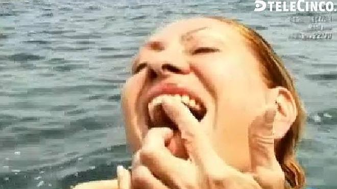 Rosa Benito se parte el labio en 'Supervivientes'
