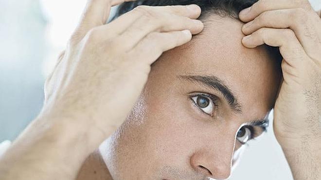 Los hombres se sienten menos atractivos cuando se les cae el pelo