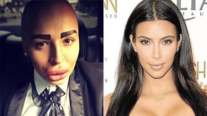 Un joven se gasta 121.000 euros en cirugía para parecerse a Kim Kardashian