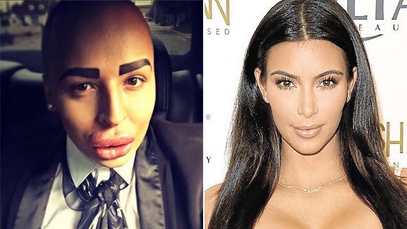 Un joven se gasta 121.000 euros en cirugía para parecerse a Kim Kardashian