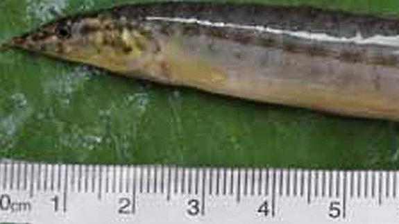 Sobrevive tras cinco horas con una anguila viva de 16 cm en la garganta