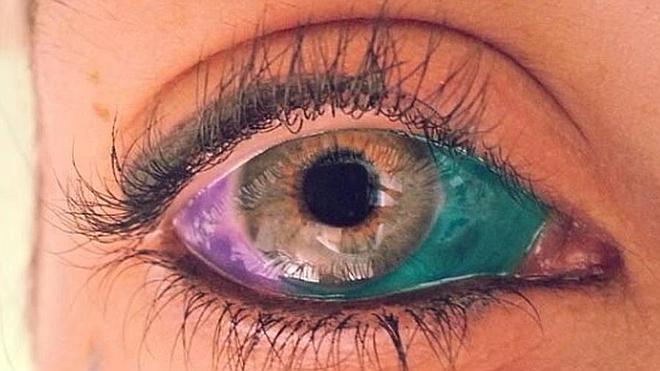 La peligrosa moda de tatuarse los ojos