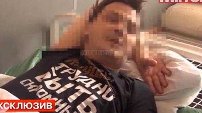 Un presentador de televisión ruso se despierta castrado en un hotel