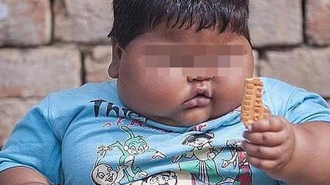 Una niña de 10 meses que pesa 20 kilos tiene a los médicos desconcertados