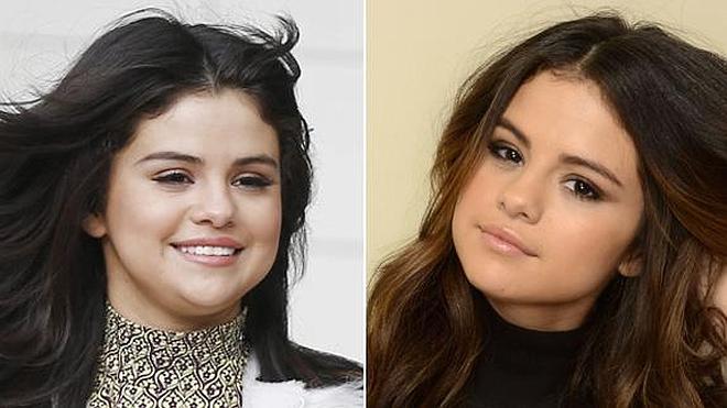 Selena Gomez, ¿nueva víctima de la cirugía?