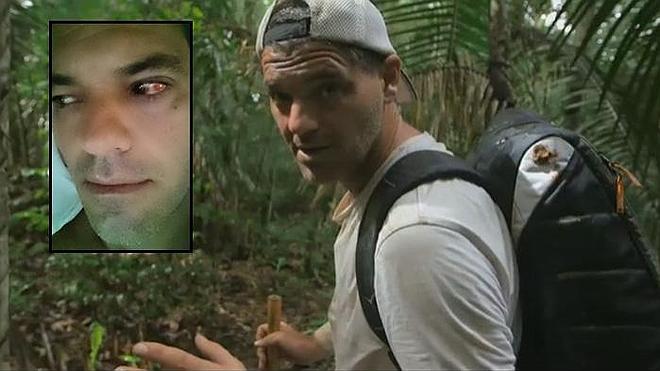 Frank Cuesta, herido tras ser atacado por una serpiente