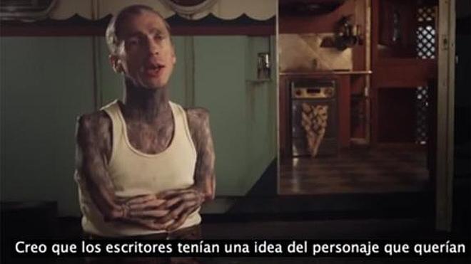 Mat Fraser, el imparable actor con malformaciones causadas por unos analgésicos
