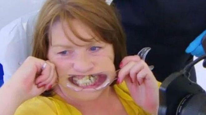 Se fija los dientes con pegamento por miedo al dentista