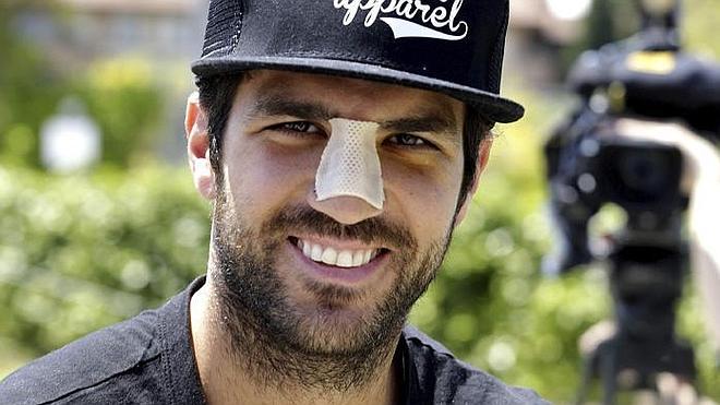 Cesc Fábregas tiene nariz nueva