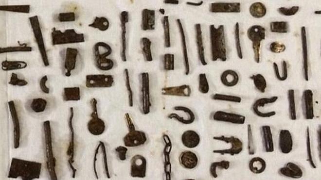 Extraen 277 objetos metálicos del estómago de un joven