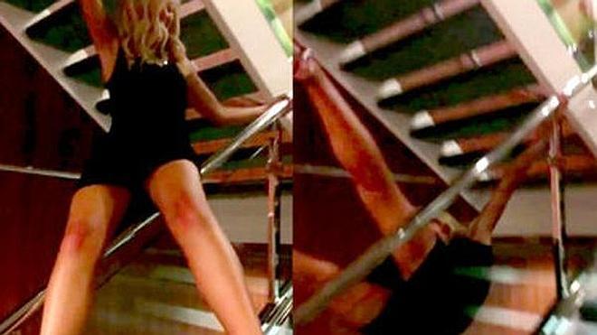 Una joven sólo se rompe una costilla tras una caída espectacular por la barandilla de una escalera