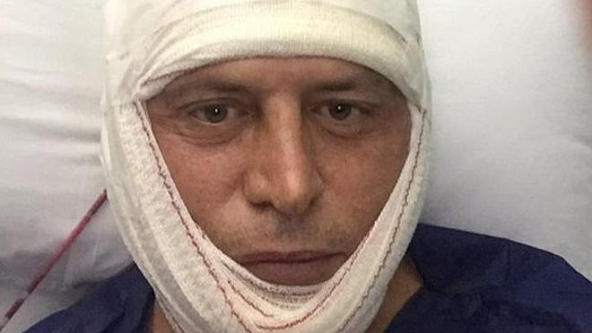 Kiko Matamoros publica su primera imagen tras salir de quirófano