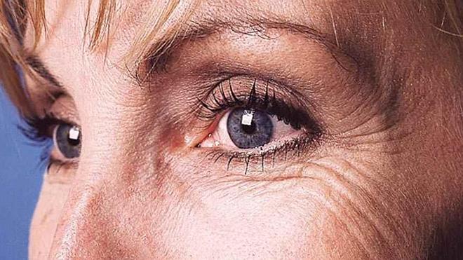 7 cosas sorprendentes que causan arrugas