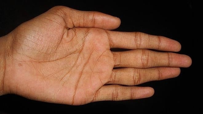 ¿Sabías que es perjudicial crujir los dedos de la mano?