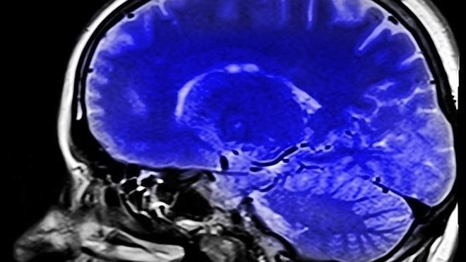 ¿Ver porno empequeñece el cerebro?