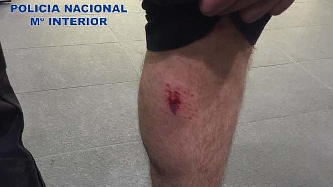 Detenida por dar un mordisco a un policía en Valencia
