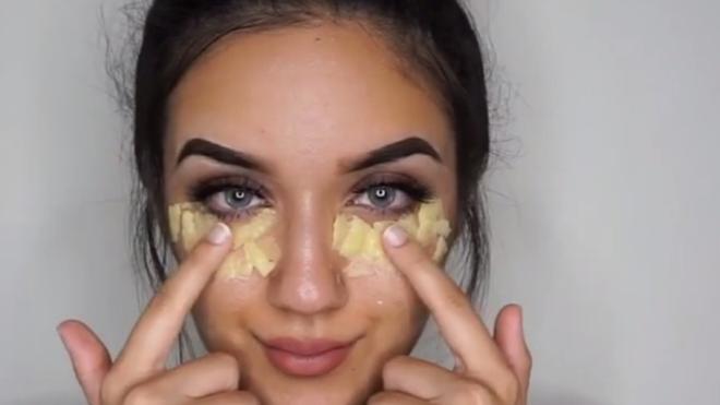 El truco de la patata: lo último para quitar ojeras