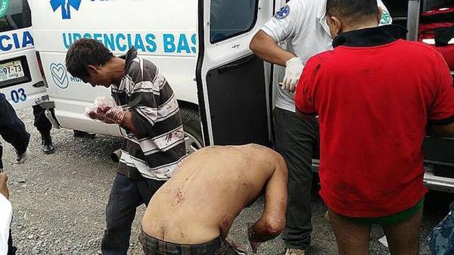El 'Grupo de élite Antirratas' amputa las manos a siete ladrones