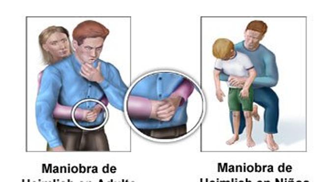 ¿Qué hacer ante un atragantamiento?