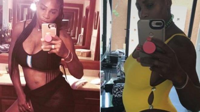 Serena Williams está embarazada