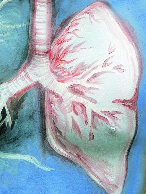 imagenes de un edema pulmonar
